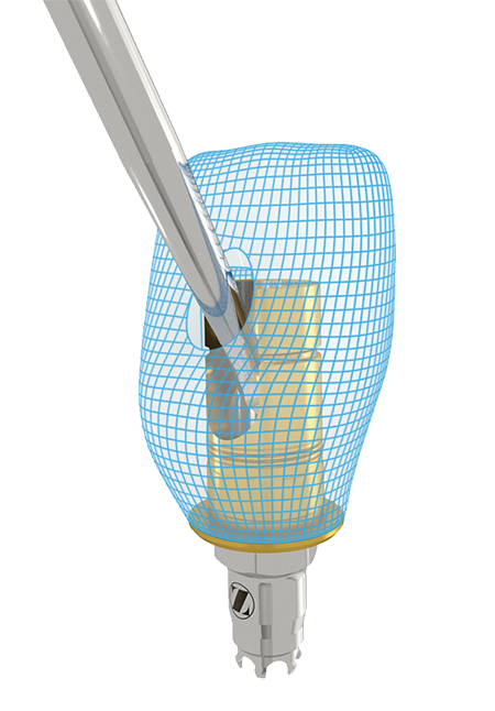 Certain® BellaTek® Express and Flex Abutments